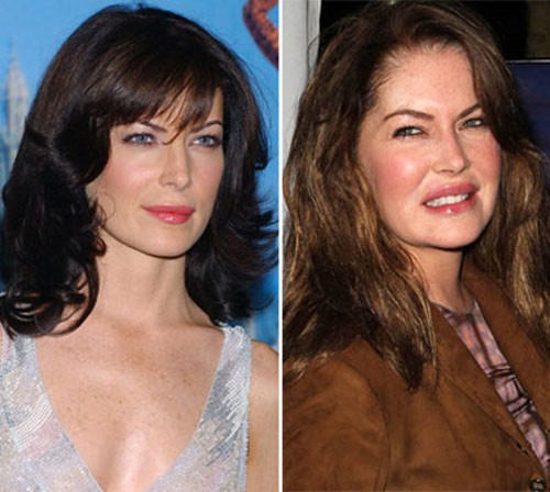 Nhìn Lara Flynn Boyle năm 2002 và năm 2010 như hai người khác nhau chỉ bởi vì đôi môi bơm silicon. Xem thêm: Sao xấu - Sao đẹp/ Thời trang sao