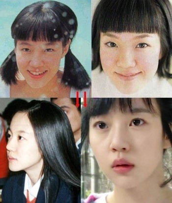 Lim So Jeong của ngày hôm nay có chiếc mũi, đôi mắt và chiếc cằm duyên khác hẳn thời thiếu nữ. Ai tin nổi đây là cùng một người? (Ảnh: tienphong) Xem thên: Sao và những cuộc trùng tu nhan sắc/ Nghệ thuật chăm sóc da tươi sáng, mịn màng.