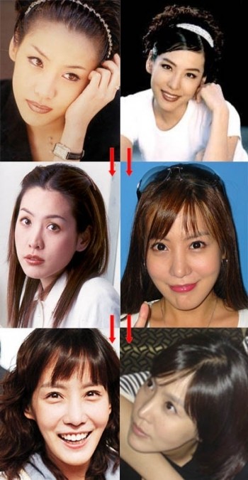 Kim Jung Eun chắc chắn đã chỉnh sửa mũi và cằm. (Ảnh: tienphong) Xem thên: Sao và những cuộc trùng tu nhan sắc/ Nghệ thuật chăm sóc da tươi sáng, mịn màng.