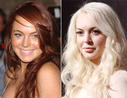 Lindsay Lohan mới 25 tuổi nhưng trông như phụ nữ trung niên bởi khuôn mặt bơm botox quá đà. Trông cô hiện tại khác hẳn với Lindsay Lohan tươi trẻ năm 2004. Xem thêm: Điểm danh những chiếc cằm mới của Sao Việt