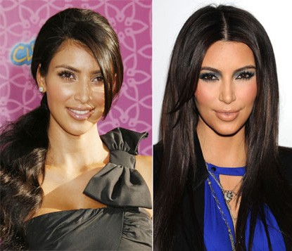 Kim Kardashian chỉ thừa nhận bơm một chút botox nhưng nếu so sánh khuôn mặt cô từ năm 2008 đến 2012, có thể thấy người đẹp "siêu vòng 3" này đã thay đổi ghê gớm. Xem thêm: Điểm danh những chiếc cằm mới của Sao Việt