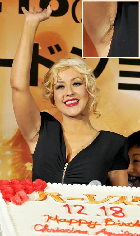 Christina Aguilera đã khiến tin đồn cô nâng ngực có thêm bằng chứng khi để lộ ra vết sẹo nhăn nhúm dưới nách. Xem thêm: Bằng chứng tố Angela Baby cậy nhờ dao kéo để xinh đẹp.