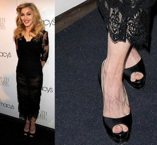 Vẻ gợi cảm của Madonna bị trừ điểm nghiêm trọng khi mọi người lướt xuống chiếc móng chân ố vàng của cô. Xem thêm: Nghệ thuật chưng diện "màn hình phẳng" của Sao Hoa ngữ