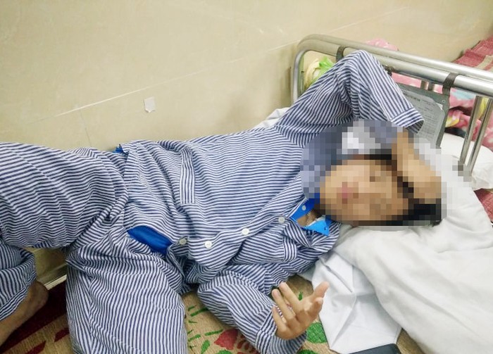 Cháu Hoàng Công Khanh (học sinh lớp 8) bị một nhóm đối tượng đánh vỡ xương hàm (Ảnh: LT)