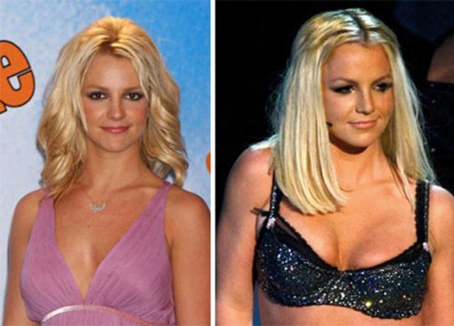 Britney Spears ngực lép (trái) và sau khi đã qua công nghệ... PTS (phải).