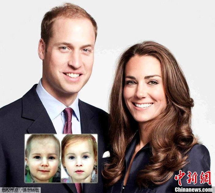 Hình ảnh khuôn mặt của em bé tương lai nhà Kate và William.Ảnh. Chinanews.