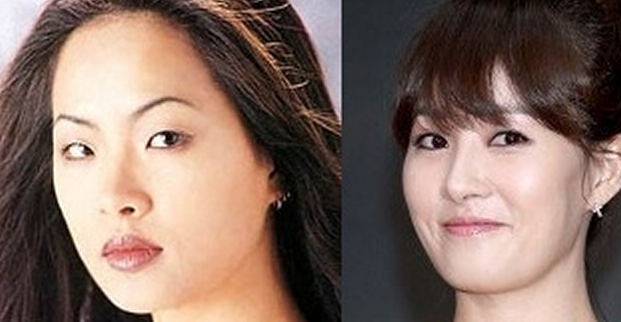 Nữ diễn viên Kim Sun Ah của phim "Tên tôi là Kim Sam Soon" hoàn toàn là một gương mặt khác so với Kim Sun Ah của ngày trước.