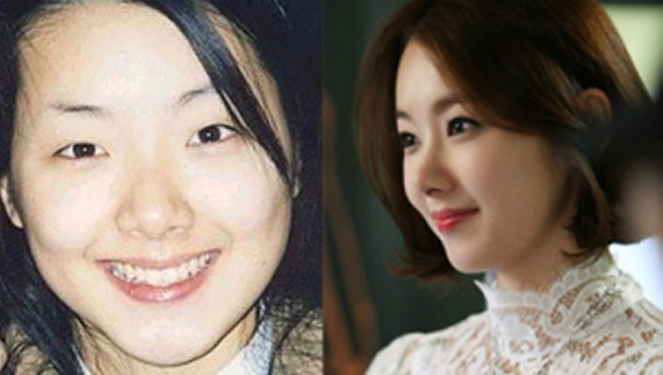 Nữ diễn viên So Yi Hyun của ngày chưa nổi tiếng không sở hữu những nét mềm mại và thanh tú của hiện tại..