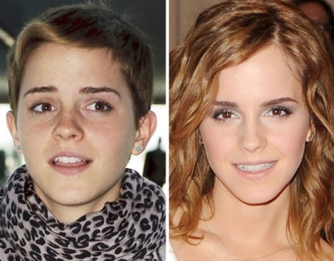 Emma Watson từng là ngôi sao có gương mặt đẹp nhất thế giới 2011 do tạp chí điện ảnh Mỹ Independent Critics bình chọn.