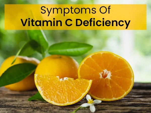Tiêu thụ lượng vitamin C ít hơn được cho là gây thiếu vitamin C. (Ảnh: theo boldsky).