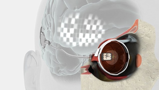 Ngày hôm nay, Bionic Vision Australia (BVA), nhóm chế tạo mẫu mắt điện tử thông báo sự thành công của họ trong việc thiết kế mẫu mắt điện tử "đầu tiên trên thế giới".