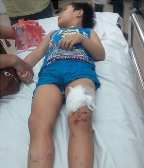 Một cháu bé bị thương đang được điều trị tại bệnh viện.
