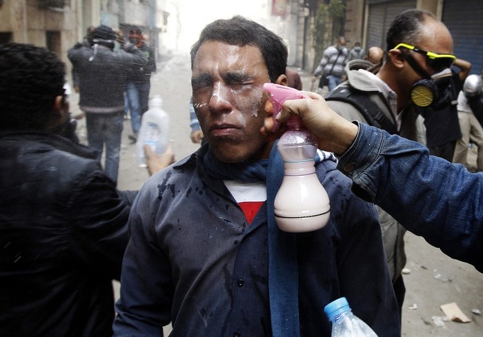 Một người biểu tình đang được phụt sữa vào mặt để trung hòa dung dịch từ đạn hơi cay của lực lượng chống bạo động.