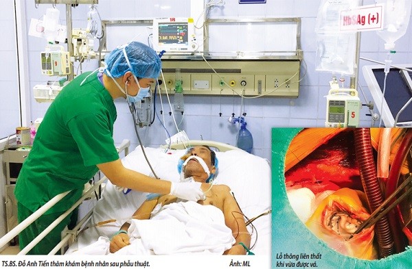 Tiến sĩ-Bác sĩ Đỗ Anh Tiến thăm khám cho bệnh nhân sau phẫu thuật. ảnh: Trung tâm tim mạch.