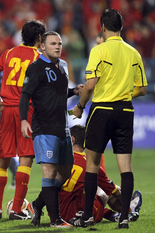 Không ngạo mạn như Ronaldo, nhưng Rooney lại thường xuyên có những tình huống xử lý rất... không bình thường. Cuộc sống trác táng ngoài sân có cũng là một trong những lý do khiến tiền đạo này bị ghét