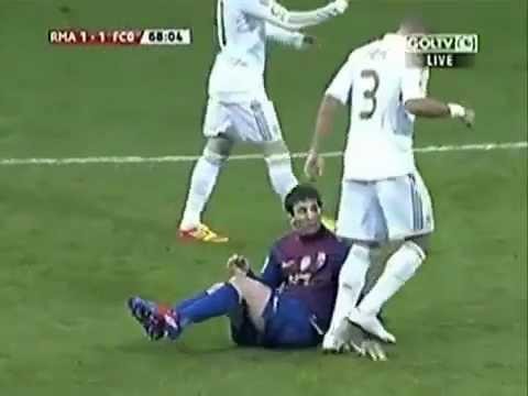 Tay Messi vẫn còn thâm tím bởi cú giẫm ác ý của Pepe  ảnh 1
