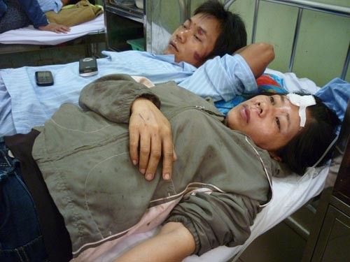 Vụ TNGT ở Bình Thuận: Không cứu kịp vì xe cháy dữ quá! ảnh 2
