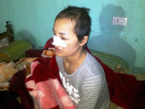  Chị Nguyễn Thị D. bị phụ nữ cùng xã cắt tóc, đánh đập và chà quả đùng đình lên người.