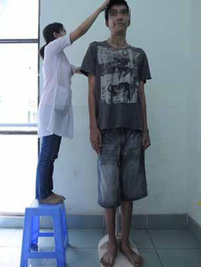 Phát hiện chàng trai mắc bệnh khổng lồ tại Việt Nam ảnh 1