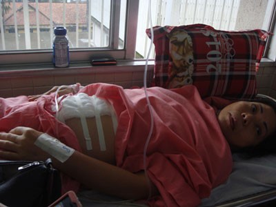 Chị Yến điều trị sau phẫu thuật vá bang quang tại Khoa Ngoại – Niệu, Bệnh viện Chợ Rẫy TP.HCM.