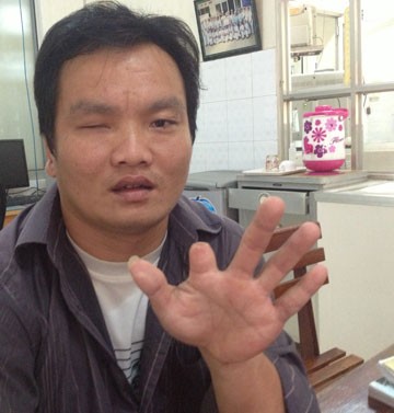 Đồng Nai: Mẹ cắn đứt ngón tay con vì mê tín ảnh 2