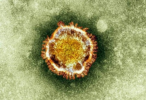 Cấu trúc của virus mới coronavirus.