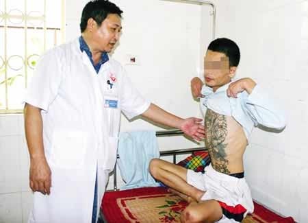 TS Nguyễn Mạnh Hùng đang khám cho bệnh nhân tâm thần do nghiện ma túy đá đang điều trị tại Khoa Cai nghiện (BV Tâm thần Trung ương 1). Ảnh: HN