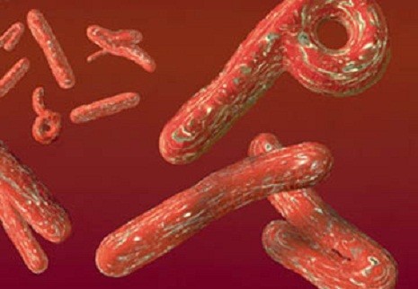 Virus Ebola.