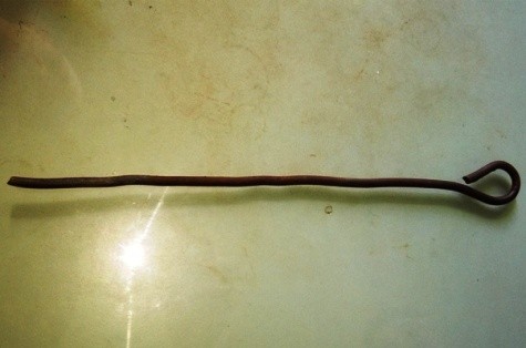 Thanh thép dài 40 cm được lấy ra từ hậu môn bé trai