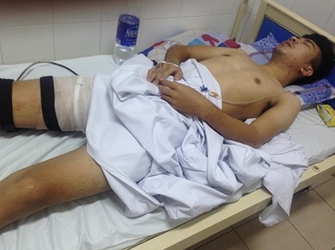 Nạn nhân Nguyễn Thành Trung đang được điều trị tại Bệnh viện Việt Đức (ảnh: THỤY DU)