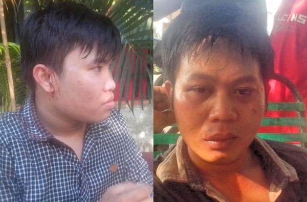 2 phóng viên Vĩnh Phú (phải) và Linh Hoàng (trái) đầy thương tích sau khi bị nhóm côn đồ hành hung (ảnh: Báo Giao thông)