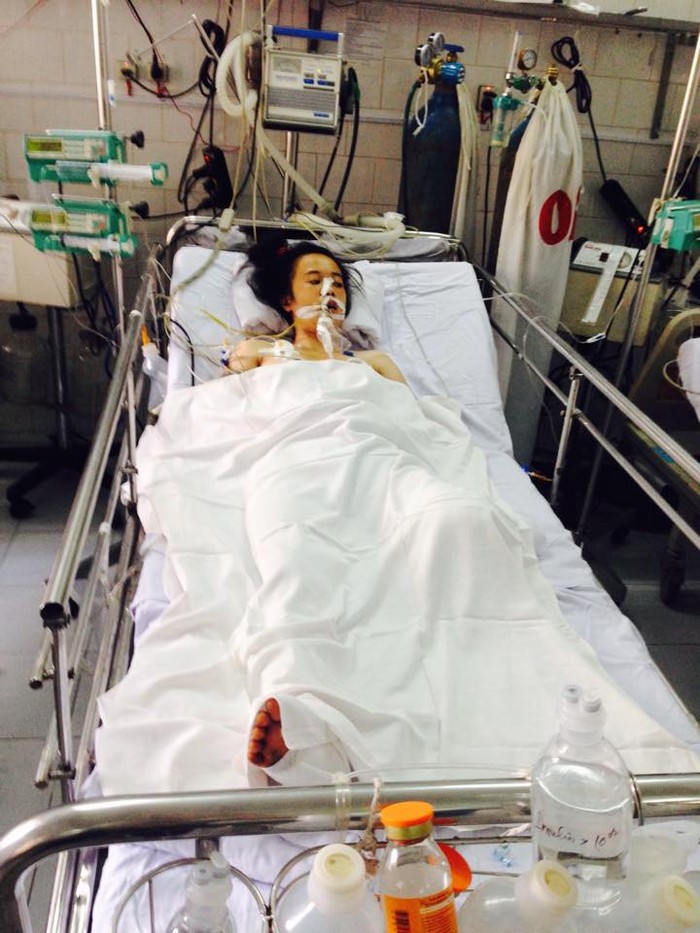 Chị Nguyên buộc phải cắt bỏ 1 chân, chân còn lại gia đình chị Nguyên đang làm các thủ tục để có thể phẫu thuật sớm nhất tại Bệnh viện Việt Đức Hà Nội (ảnh: Báo Người Hà Nội).