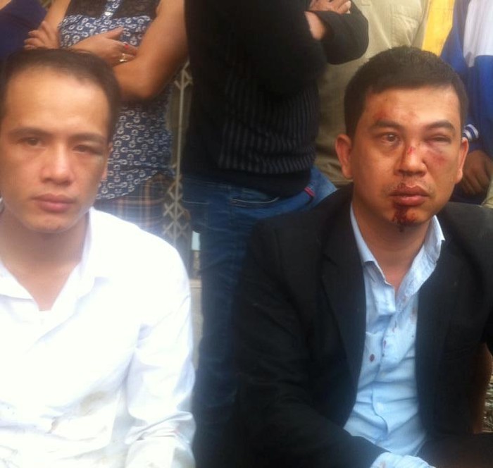 Hai luật sư bị hành hung trong quá trình thực hiện nhiệm vụ (ảnh: Vietnamnet).