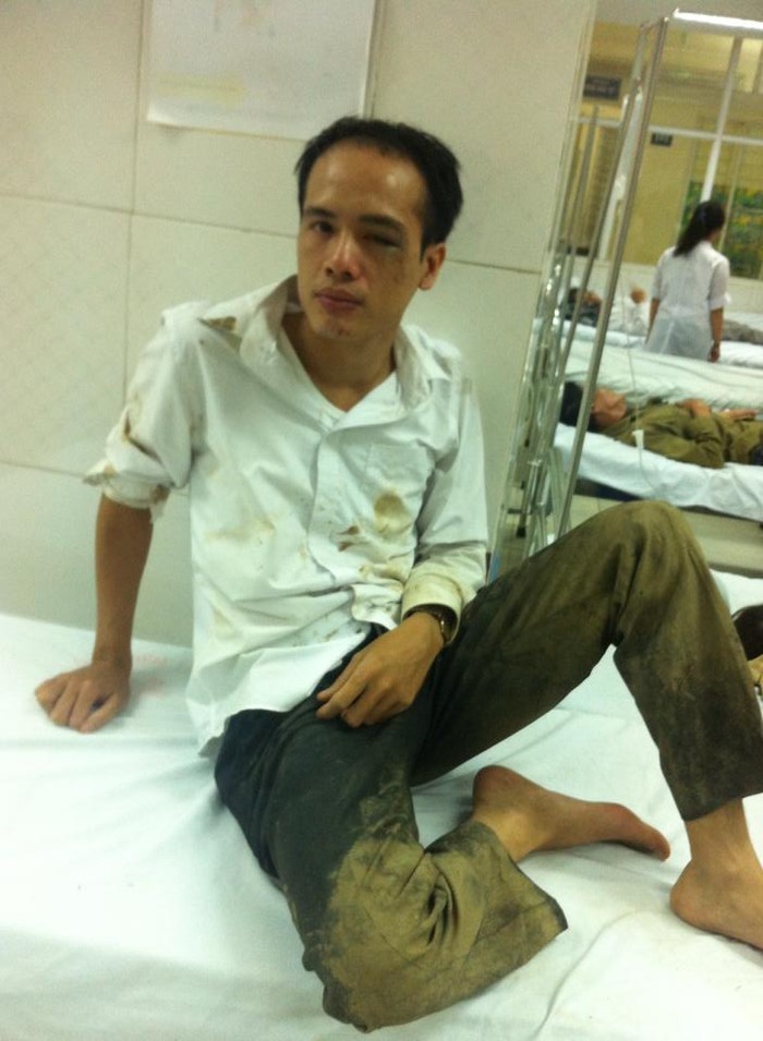 Luật sư Lê Văn Luân bị hành hung hôm 3/11 (ảnh nhân vật cung cấp).