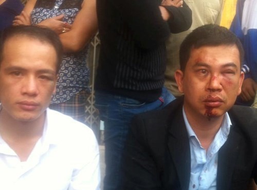 Luật sư Lê Văn Luân (trái), luật sư Trần Thu Nam (phải) là nạn nhân trong vụ hành hung hôm 3/11 (ảnh: Nhân vật cung cấp).