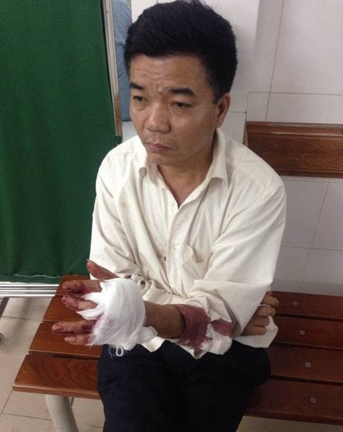 Ông Nguyễn Đoàn Bộ bị thương trong vụ xô xát với ông Nguyễn Minh Tâm (ảnh: Nhân vật cung cấp).