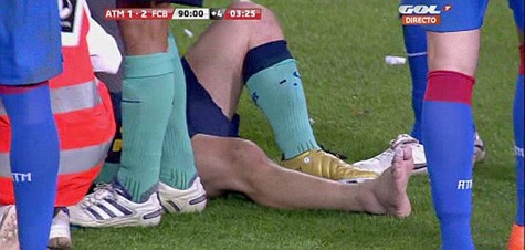 Messi với cái cổ chân sưng vù sau pha vào bóng của Ujfalusi.