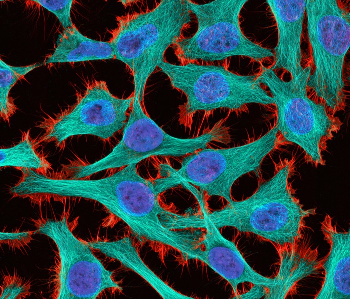 Các tế bào ung thư HeLa được phóng đại lên 300x qua bức ảnh của Thomas Deerinck thuộc trung tâm Quốc gia về Kính hiển vi và nghiên cứu hình ảnh ở La Jolla, California.