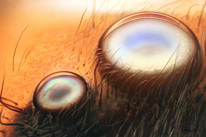 Hai con mắt (một bên phía trước và giữa) của một cá thể loài nhện nhảy được chụp bởi Walter Piorkowski, đến từ Nam Beloit, Illinois.