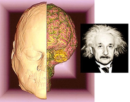 Bộ não của Einstein ảnh 4