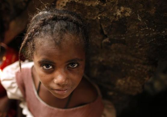 Một bé gái người thiểu số Akhdam ở thủ đô Sanaa, Yemen.