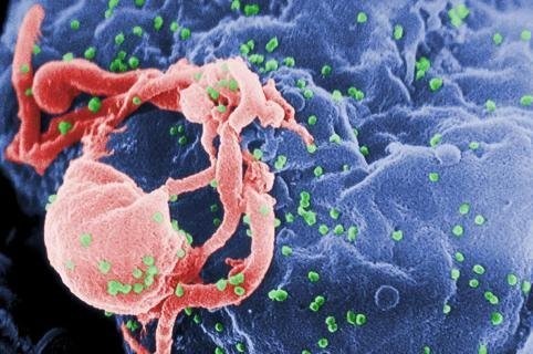 Virus HIV quan sát dưới kính hiển vi.