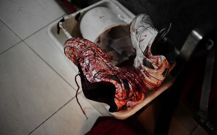 Đôi giày đẫm máu ở lối vào một bệnh viên Aleppo.