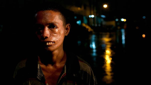 Jasper Vito đứng trên một đường phố trong khu ổ chuột Binondo. Vito sinh ra đã có một khuôn mặt biến dạng và phải vật lộn kiếm đủ tiền sính sống.