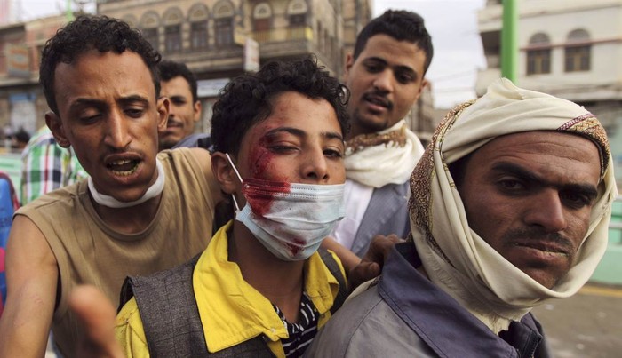Tại Sanaa, Yemen, một người biểu tình đang bị thương saucuộc đối đầu với cảnh sát chống bạo động. Họ đã bắn súng hơi cay vào đoàn người biểu tình bên ngoài Đại sứ quán Mỹ ở thủ đô Sanaa.