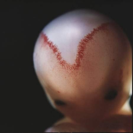 Thai nhi 9 tuần: mạch máu hình chữ V trong hộp sọ bắt đầu phát triển hợp nhất với nhau.