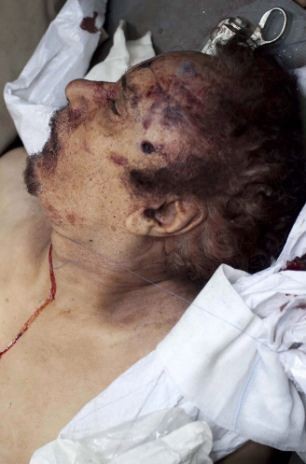Thi thể Gaddafi lúc đã chết