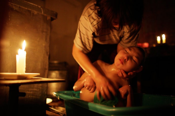 Mayra Zhumageldina đang tắm cho cô con gái Zhannoor 16 tuổi mắc chứng đầu nhỏ và bị biến dạng cột sống do ảnh hưởng của phóng xạ. Cô bé sống như người thực vật, không có khả năng suy nghĩ, nói chuyện hay làm các động tác cơ bản.