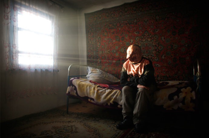 Berik Syzdykov ngồi trên giường của mình trong ngôi nhà ông sống cùng mẹ, ở gần khu vực thử nghiệm hạt nhân ở Kazakhstan hôm 25/2/2009. Berik bị nhiễm phóng xạ từ trong bụng mẹ và khi chào đời đã bị mù và mang một số dị tật bẩm sinh