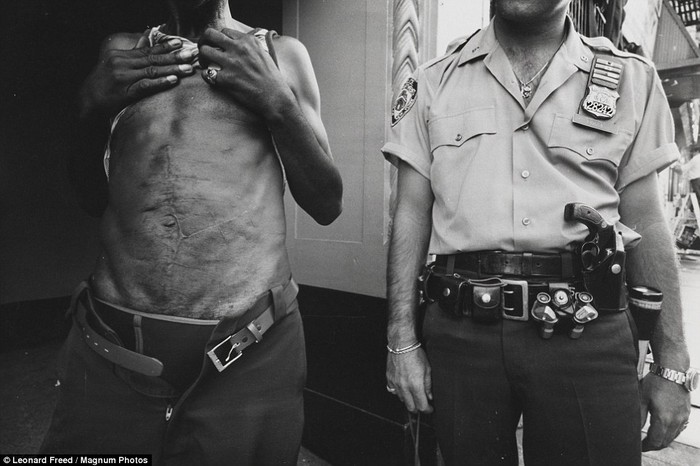 Một sĩ quan cảnh sát New York bên cạnh tên tôi phạm bụng đầy sẹo năm 1978
